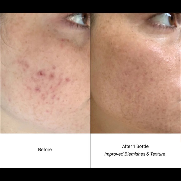 Shani Darden Retinol Reform Serum - Picture 8 of 9